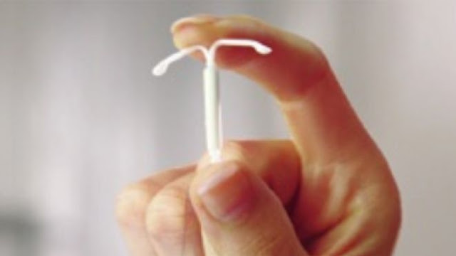 More U.S. women choosing IUDs for birth control