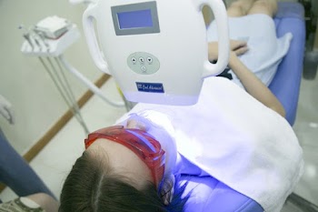 Nên tẩy trắng răng bằng phương pháp nào?