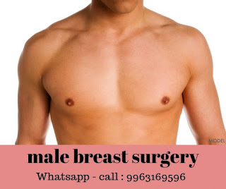 gynecomastia surgery cost in hyderabad