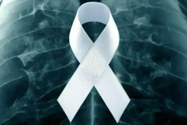 What Is the Ribbon Color for Lung Cancer Awareness