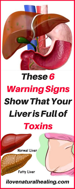 6 Signs That Your Liver is Full of Toxins