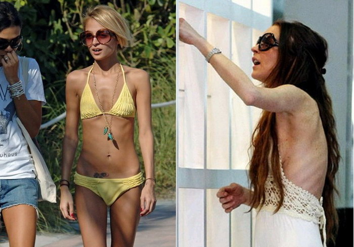 Most skinny celebrities - 21