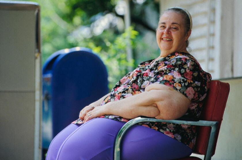 Türkiye’de her 5 kişiden 1’i aşırı kilolu veya obez