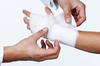 Fractura de mano: Síntomas, Cura y Tratamiento