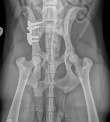 Triple Pelvic Osteotomy