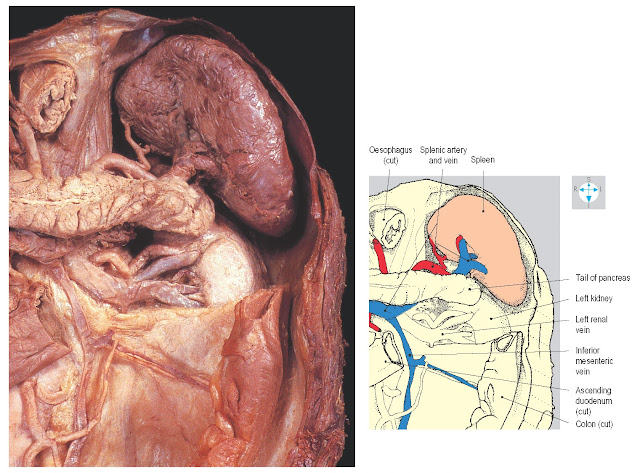 Spleen and its vessels and relationship to the diaphragm, pancreas and left kidney. The stomach and part of the colon and peritoneum have been removed.