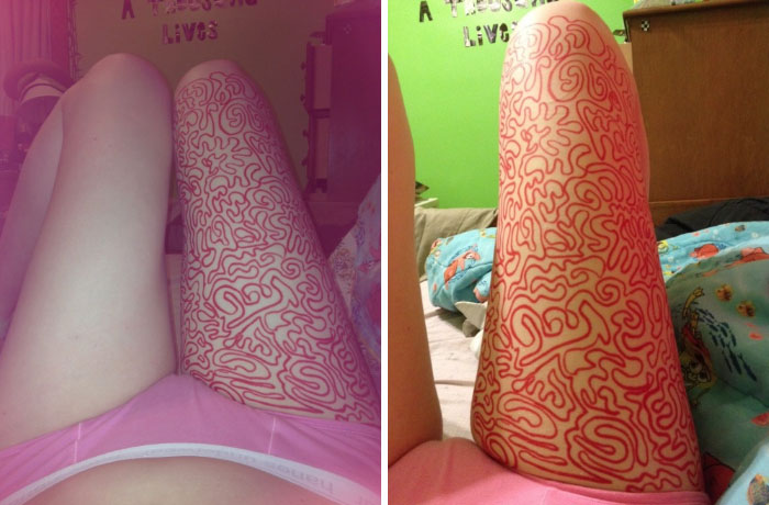 Young Woman Shared Her Therapist’s Advice To Draw On Her Body Instead Of Cutting