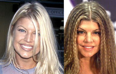 Celebrity Cellulite on Fergie Nose Jobs   Nose Jobs