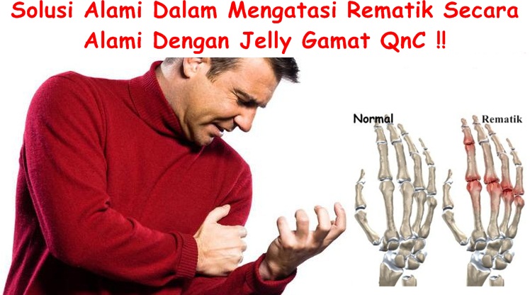 Obat Tradisional Tuntaskan Rematik