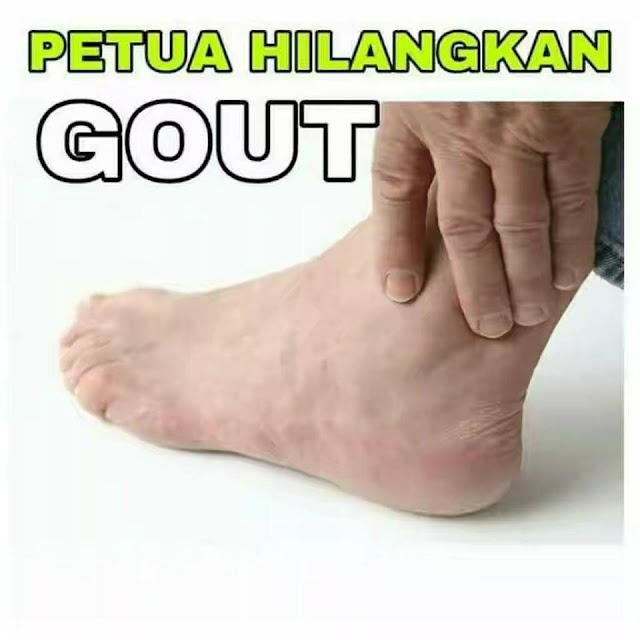 Petua Gout :Rawat dengan air tin. Paling senang.