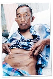 MY NEW KIDNEY - BUAH PINGGANG BARUKU: Kisah Pesakit Buah ...