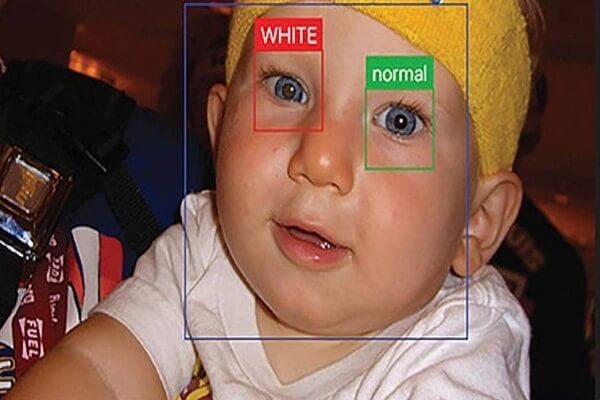 CRADLE White Eye Detector