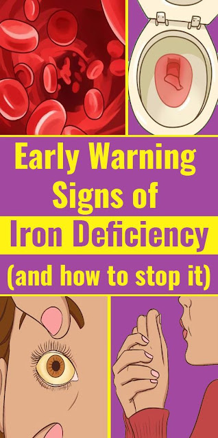 Never Ignore These Crucial Signs Of Iron Deficiency