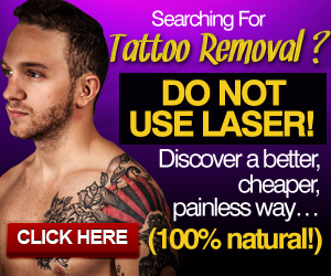  tattoo removal los angeles california 