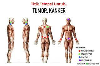 Indonesia Sehat Ads | Titik Tempel One More International Untuk Tumor dan Kanker