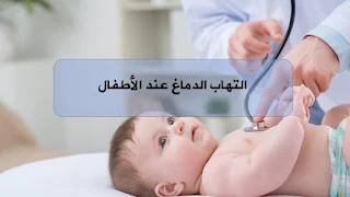 التهاب الدماغ عند الاطفال