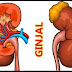 Penyakit Ginjal, Gejala, Penyebab dan Cara Mengobati
