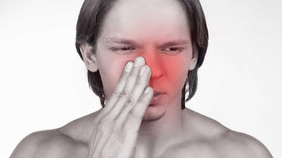 Obat Sinusitis di Apotik