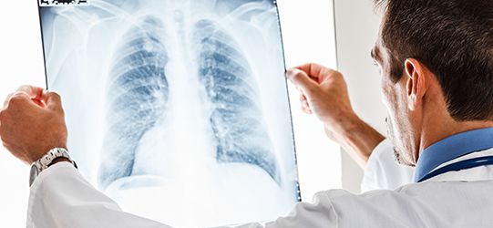 Mesothelioma Diagnosis