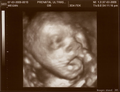 3d ultrasound 20 weeks boy. 3d ultrasound 20 weeks boy;