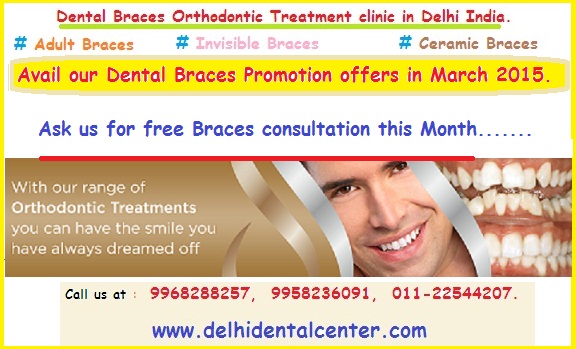 Dental Braces clinic Delhi, Dental Braces Delhi, orthodontist Delhi, Dental Braces in Delhi, Braces Dentist in Delhi, Braces Delhi, Braces Clinic in Delhi, Dental Braces Treatment in Delhi.