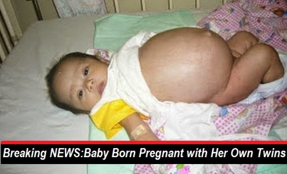 Baby In Hong Kong Born Pregnant With Her Own Twins Chennai Memes