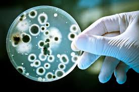 تعرفوا على : سبب ازدياد مقاومة البكتيريا للمضادات في الفضاء