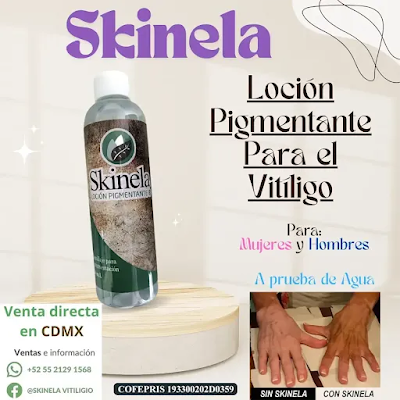 ads banner