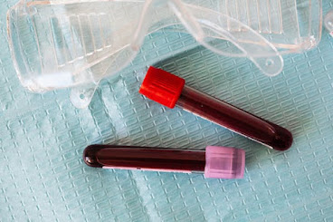 Blood discharge