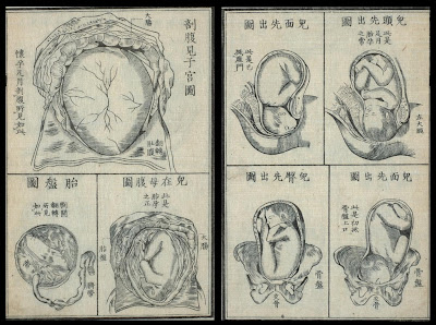 schematics of baby in utero and placenta