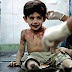 “Quando eu morrer, vou contar tudo a Deus”, afirma criança vítima da guerra na Síria