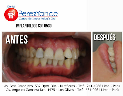  www.dentalperezyance.com