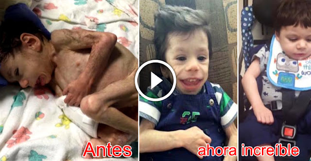 Starving 8-Year-Old Orphan Who Weighed Only 8 Lbs. Now Looks Unrecognizable