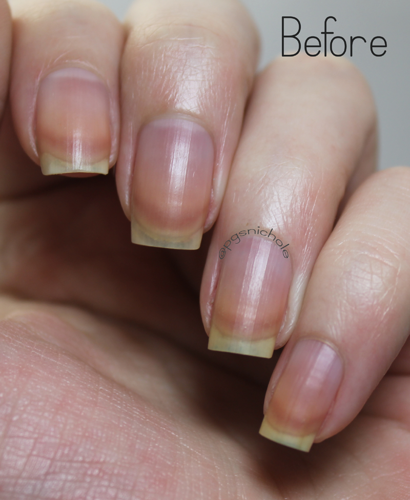 How To Whiten Yellow Nails From Nail Polish Stains