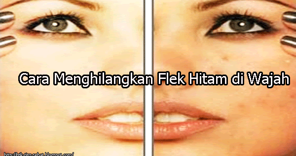 Menghilangkan Bintik Bintik Di Photoshop - WA atau SMS ...