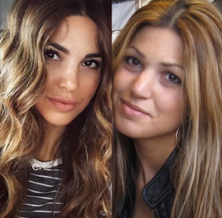 Negin Mirsalehi'nin Estetiksiz Hali