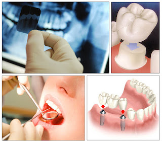 Dental Clinic Delhi