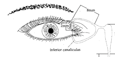 lacrimal canaliculi