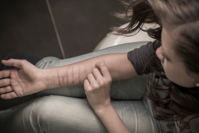 Comportamento autolesivo, menina se cortando no braço com cicatrizes, lesão, automutilação, suicida, depressão, adolescente
