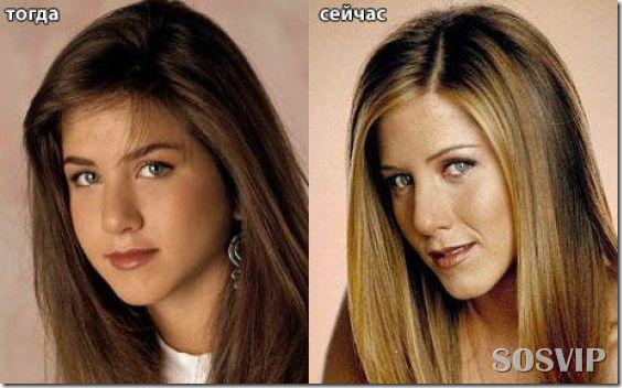 Celebridades antes e depois - Celebs before after.jpg (3)