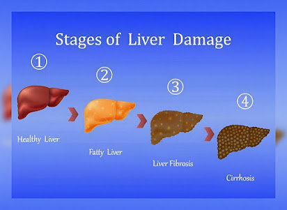 How does hepatitis damage the liver?