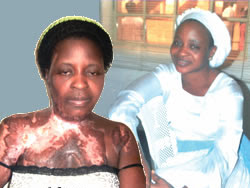 30-year-old Prophetess Set Ablaze As Trance Celebration Turned Sour