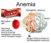 obat herbal penyakit anemia