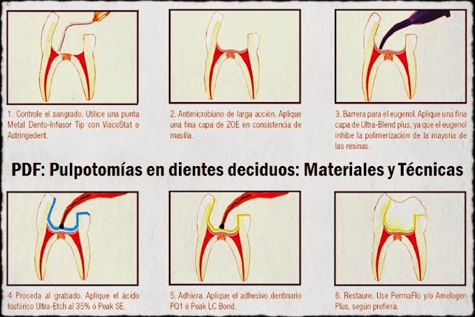 PDF: Pulpotomías en dientes deciduos: Materiales y Técnicas