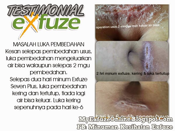 My Exfuze Online: Supplement, Kesihatan, Perniagaan 