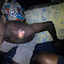 Mystery as boy 15 Uchenna Iyike goes mad, gets injury marks all over his body (Photos)