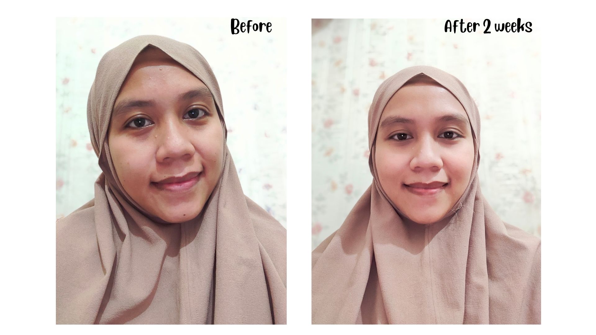 before after base skincare