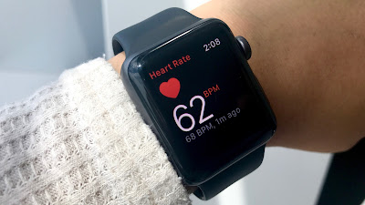 The next Apple watch might serve as an EKG monitor