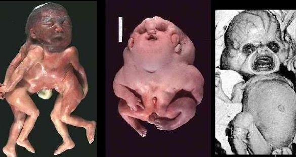 Is It Legal To Own Depleted Uranium - girlbandgeek: Depleted Uranium - Special fissionable material 50 effective grams;