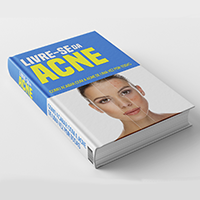 Ebook: Livre-se da Acne